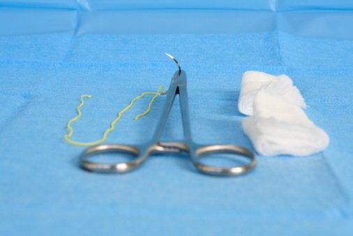 What Is A Retained Surgical Sponge? – SHOF