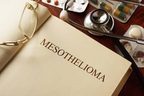 imig mesothelioma classification