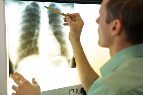 Sun Valley Fractured Vertebrae Compensation thumbnail
