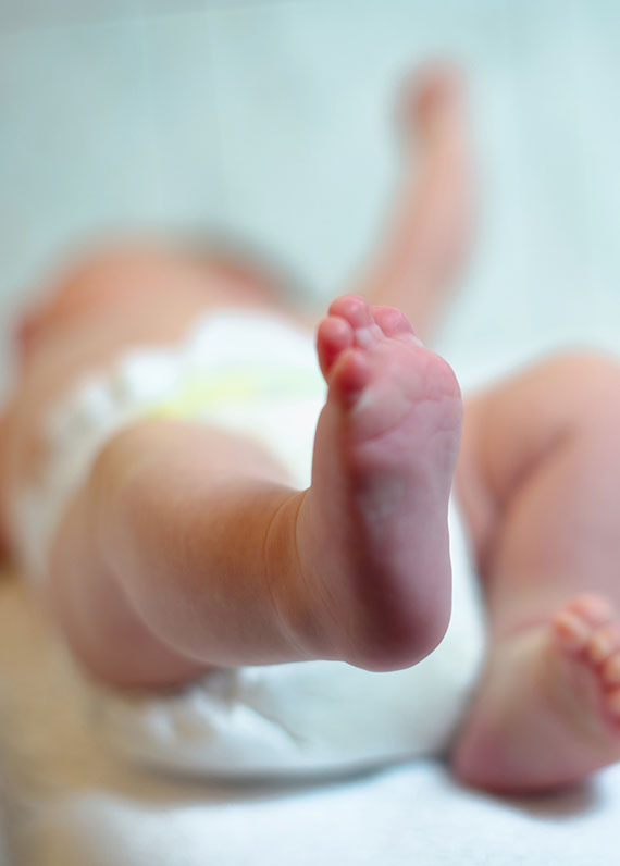 abogado de lesiones de nacimiento