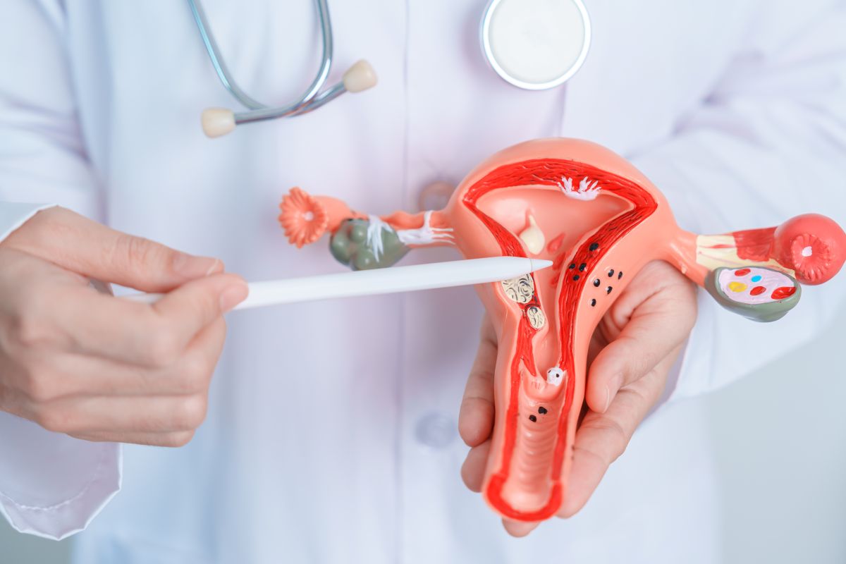 Hysterectomy Malpractice Lawsuit